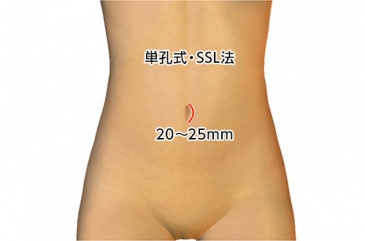 SSL法